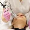 Image 1: Up to 45% Off on Laser Skin Resurfacing at Turkish Royal Aesthetic