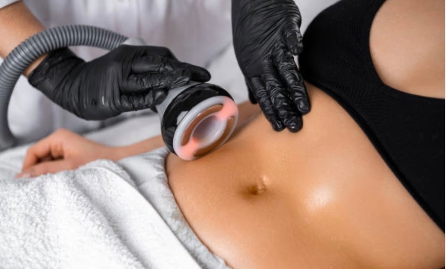Image 1: Transform Your Body with 2, 4, or 6 Ultrasonic Body Sculpting Sessions