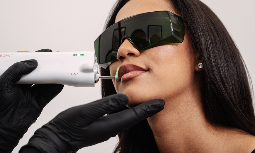 Image 10: Laser-Haarentfernung an 1 kleinen / großen Zone nach Wahl für 1 Person