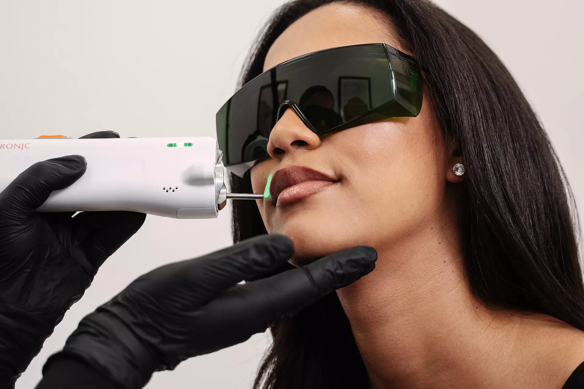 Laser-Haarentfernung an 1 kleinen / großen Zone nach Wahl für 1 Person