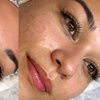 Image 6: Lash and Brow Lifting Treatments