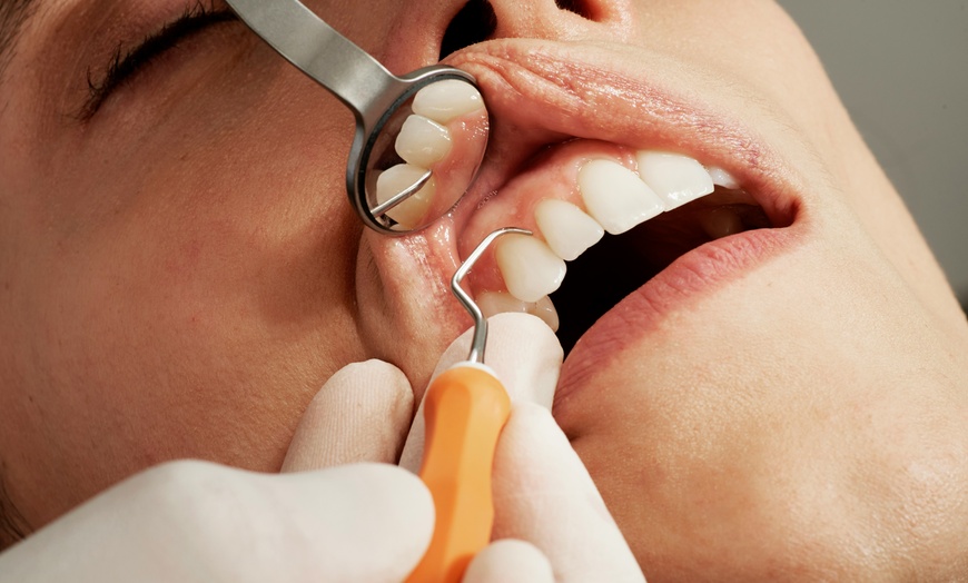Image 6: Dental Exam, Teeth Whitening, Membership, X-ray/Implant Package & More
