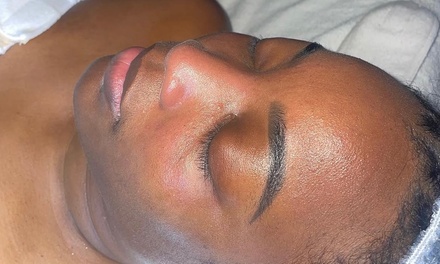 Three AHA Glycolic Chemical Peels - Diversed talented