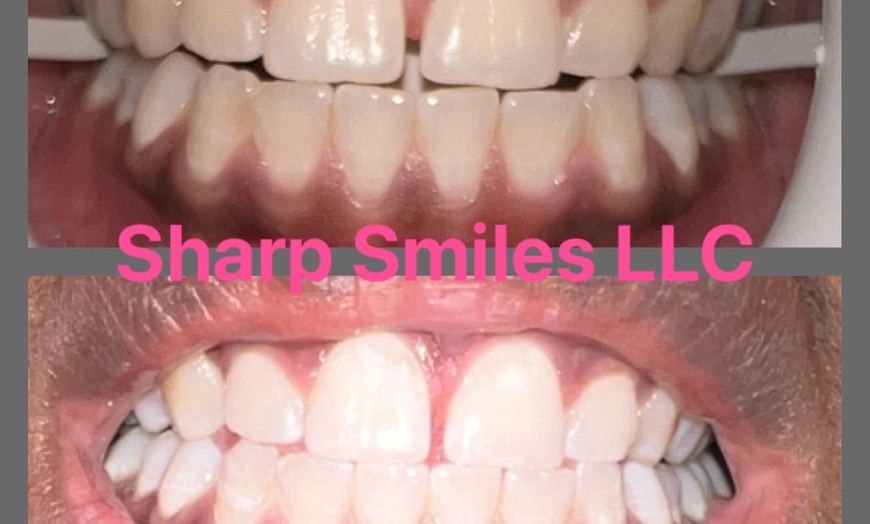 Image 7: Brighten Your Smile With Teeth Whitening, Polishing & More 