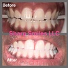 Image 7: Brighten Your Smile With Teeth Whitening, Polishing & More 