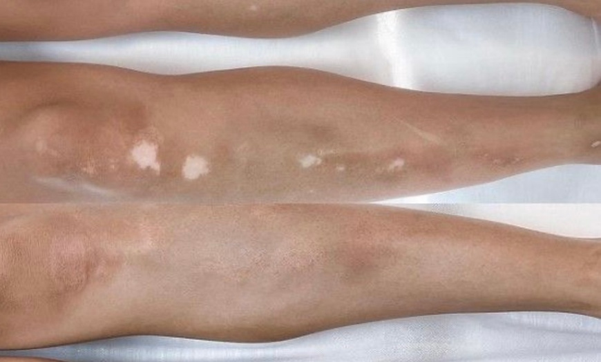 Image 2: Up to 50% Off on Tattooing at Pompano Esthetics