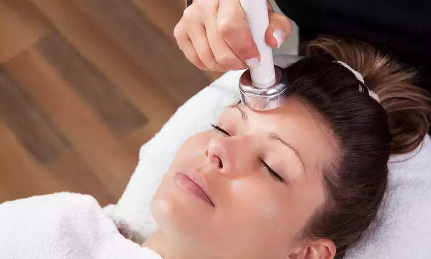 Up to 50% Off on Micro-Needling at OC Beauty Medspa - Primary Image