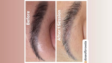 Non-Invasive Eyebrow Magnetic Tattoo Removal  - Doseofbrows