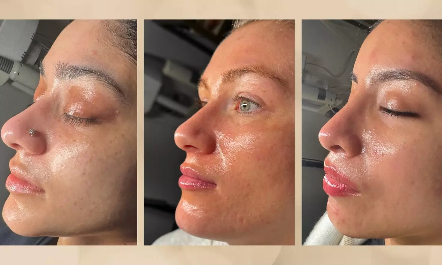 One, Two, or Three 60-Minute Custom Glow Facials with Chemical Peel OR Dermaplanning Sessions (Up to 55% Off)