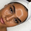 Image 5: Radiant Skin Awaits: Signature & Platinum Hydrafacial Packages