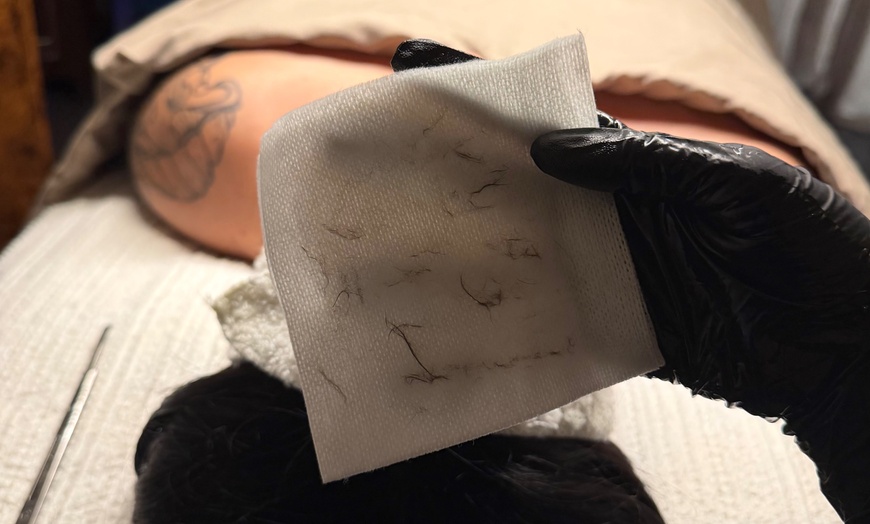 Image 3: 1,2 or 3 Dermaplane w/ HydroBoost, Brightening Peel + LED (75 mins)