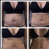 Image 5: Single Session of BodyFX or MiniFX Fat Reduction and Skin Tightening