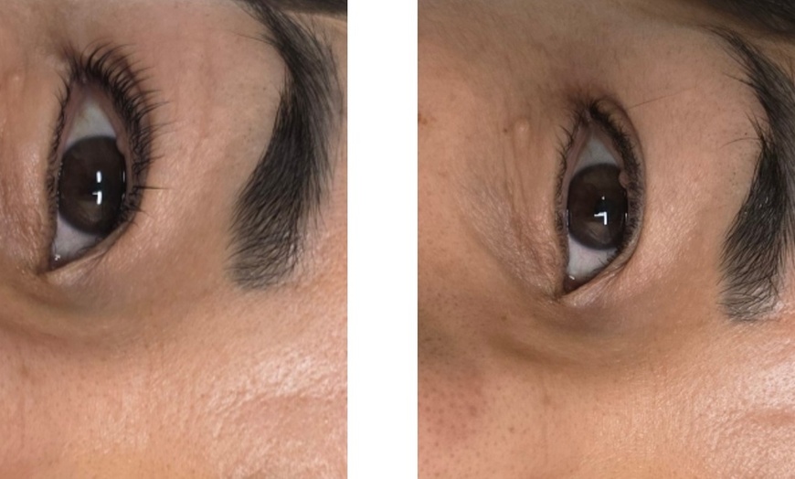 Image 2: Elevate Your Look: Eyelash Lift and Tint Treatment