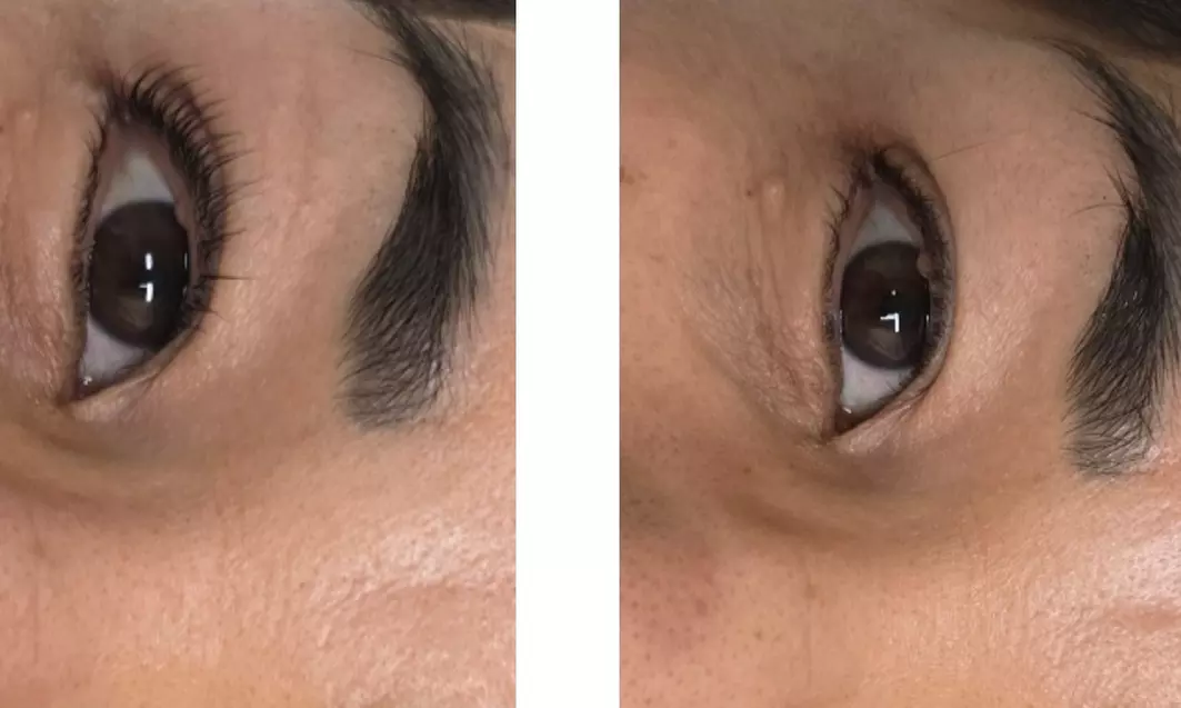 Elevate Your Look: Eyelash Lift and Tint Treatment