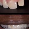 Image 9: Dental Crowns, Dental Exam, X-rays & Cleaning, Dentures & More