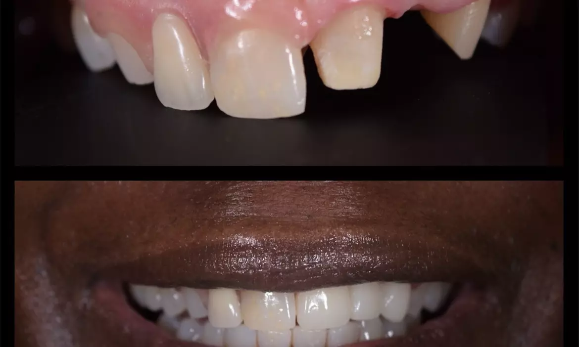 Dental Crowns, Dental Exam, X-rays & Cleaning, Dentures & More