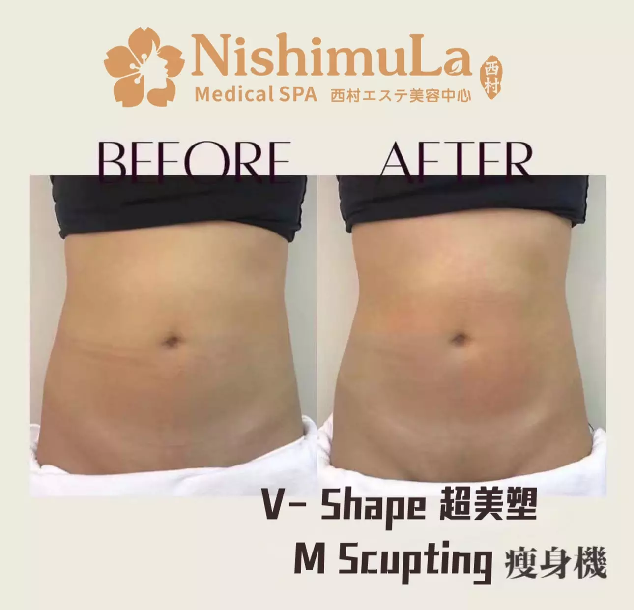 30-Minute EMS Muscle Sculpting Session for One or Two areas