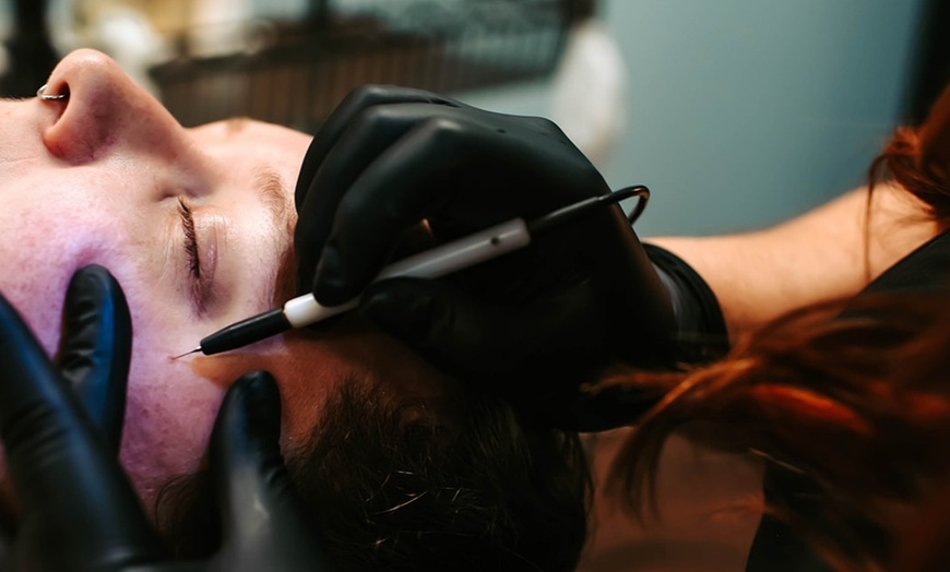 Image 1: Get One or Three Skin Irregularities at Panda Pampering with up to 30% Off