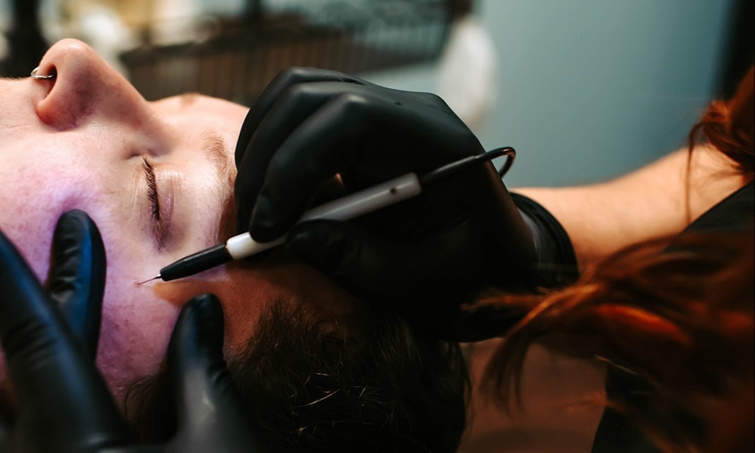Get One or Three Skin Irregularities at Panda Pampering with up to 30% Off