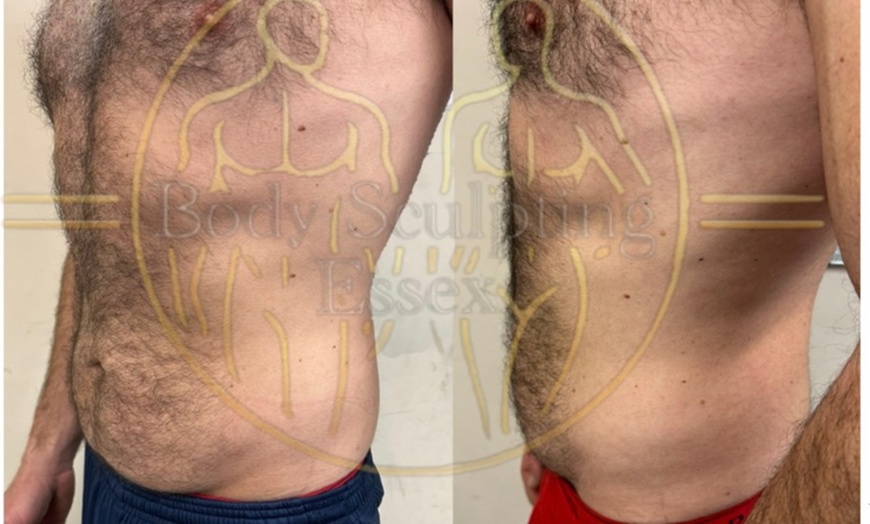 Image 5: Single or Two Area Sculpting, Private Sauna, Body Sculpt, & More