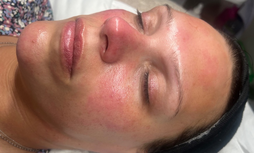Image 5: Relax with a 60-Min Deep Cleanse Facial or Bye Peach Dermaplane Facial