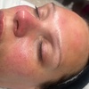 Image 5: Relax with a 60-Min Deep Cleanse Facial or Bye Peach Dermaplane Facial
