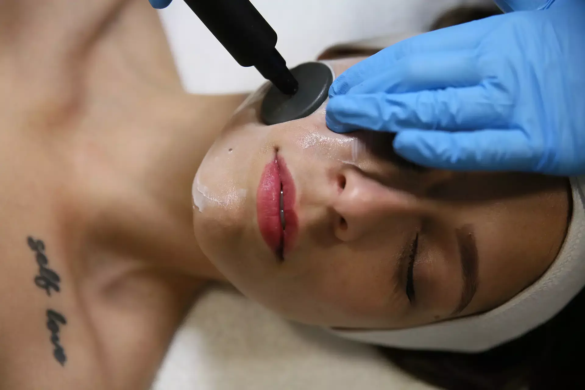 Tratamiento facial con Indiba, velo de colágeno y terapia lumínica