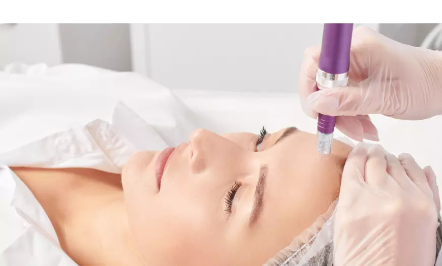 Image 1: Skin-Needling Face and Neck Refresh – One, Two or Three Sessions
