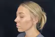 One or Three Laser Skin Brightening Treatment at River Oaks Galleria Medspa - Up to 51% Off - Second Medium