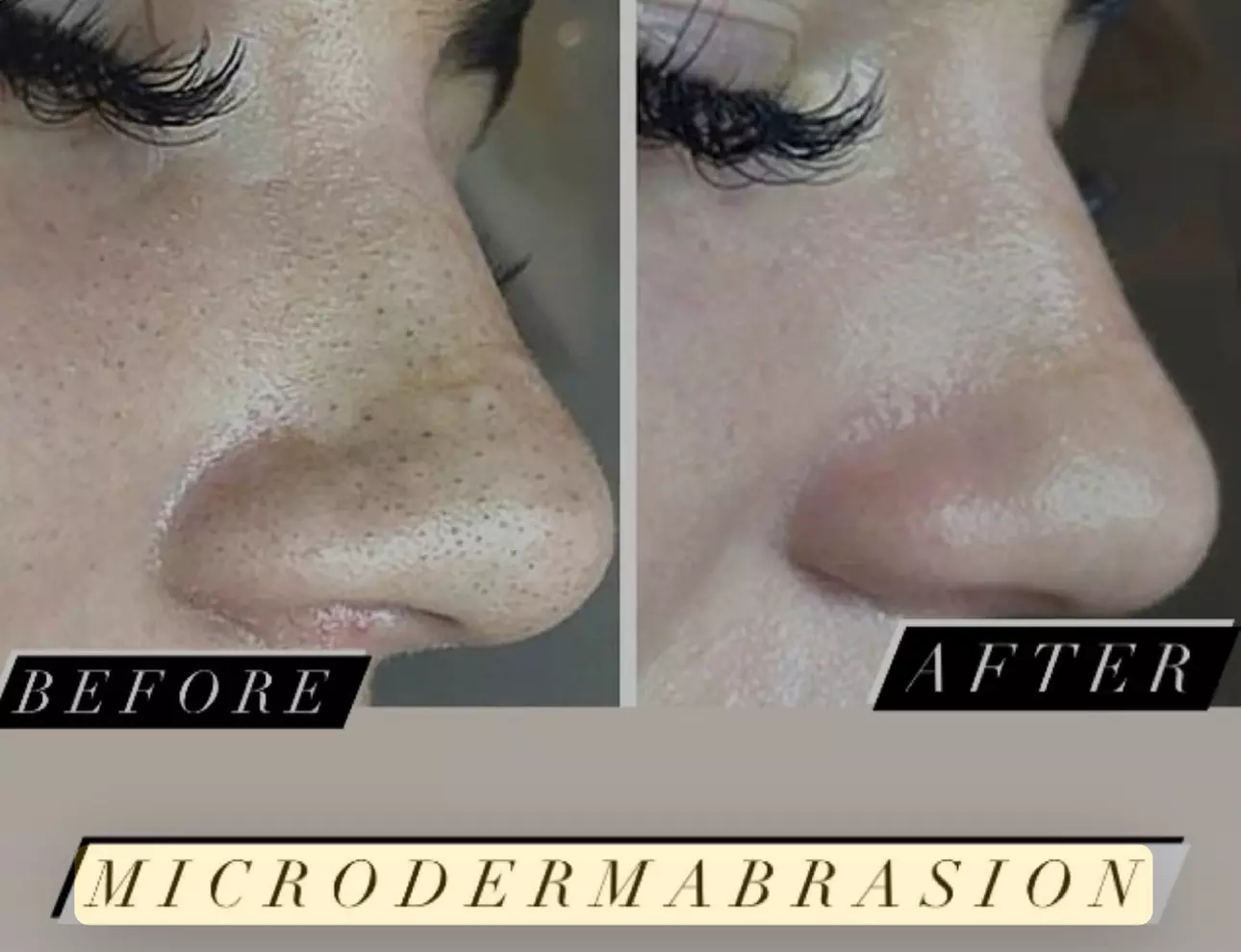 Up to 35% Off on Facial at Ursula Versace Aesthetics