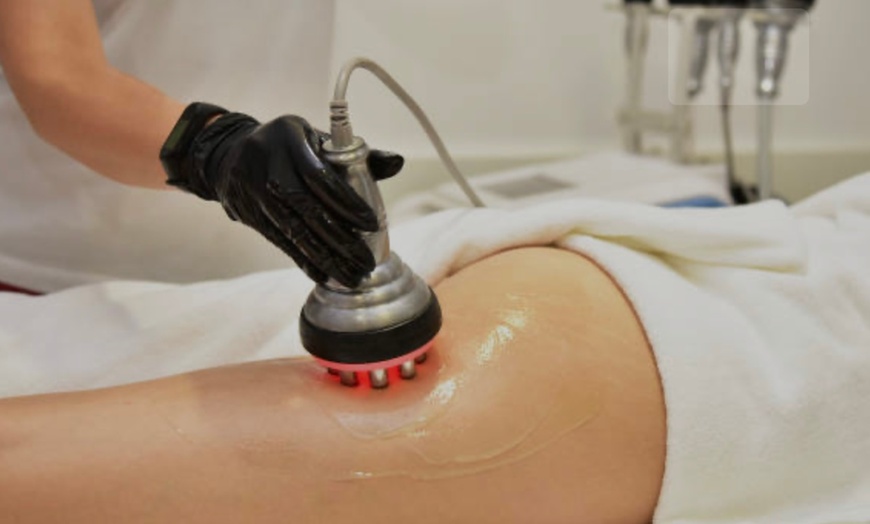 Image 3: Up to 40% Off on Body Sculpting at Cryo Republic Wellness and Recovery Studio