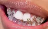 Sparkling Smile Awaits with Professionally Applied Tooth Gems at Smile Bar ( Up to 50% Off )