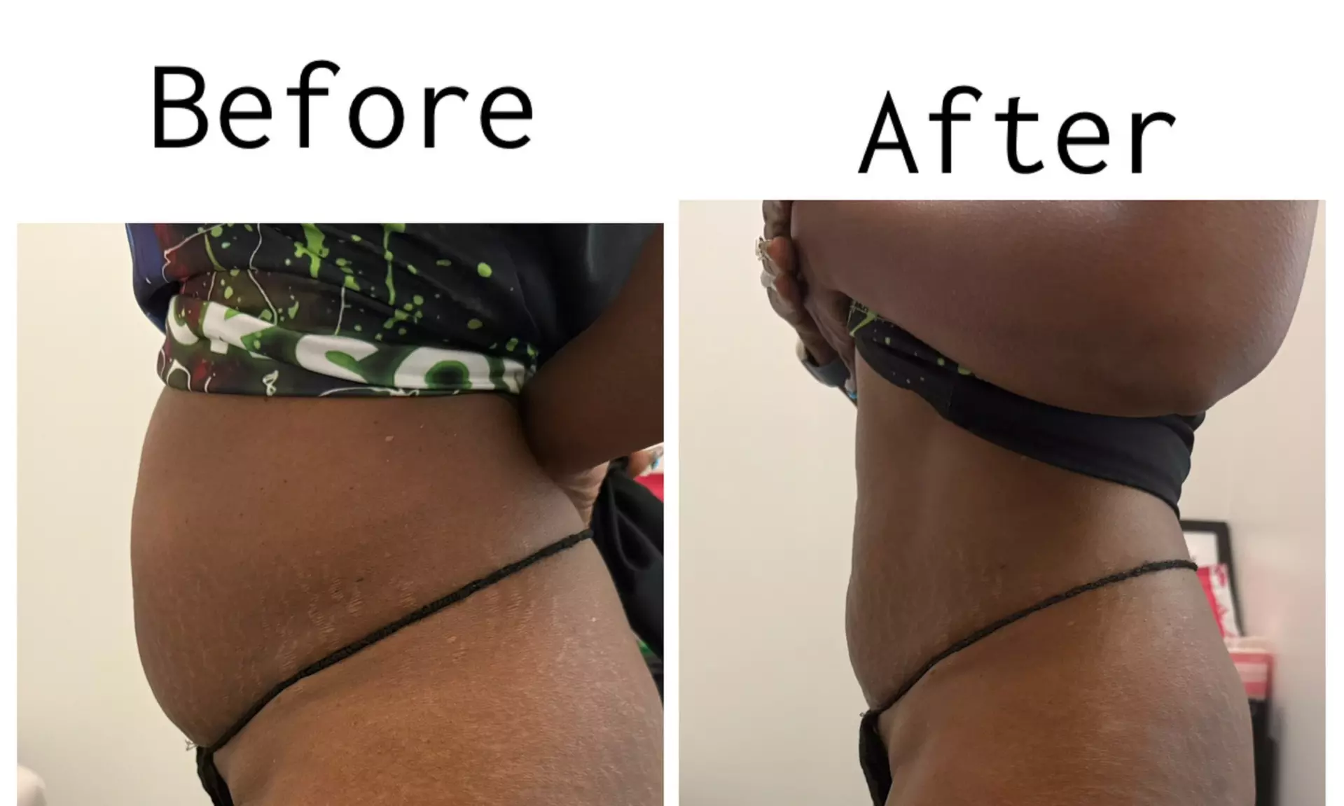 Up to 60% Off on Cavitation at Dyamond sculpted