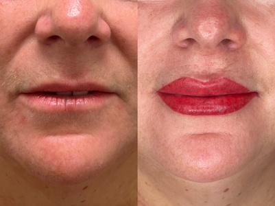 Lip Brush Tattoo / SPMU - bc clinic