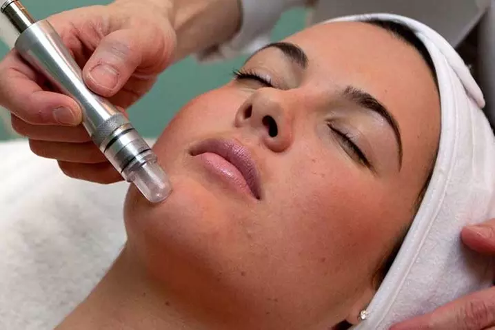 Get Radiant Skin with Microdermabrasion and Custom Facial