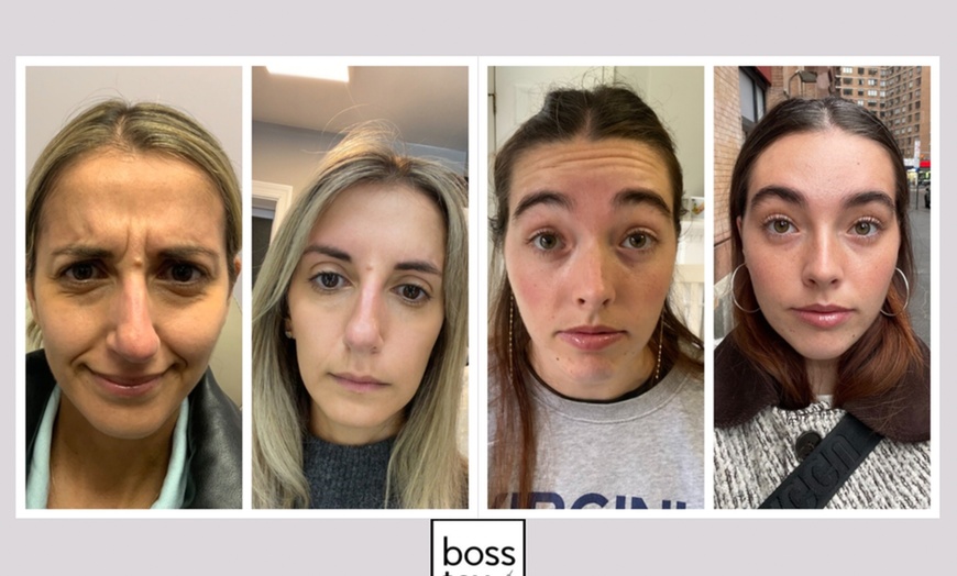 Image 6: Refresh Your Look with 10, 20, or 30 Units of Xeomin/Jeuveau