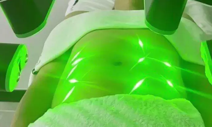Transform with Next-Generation 10D & Advanced Laser Lipo Treatments
