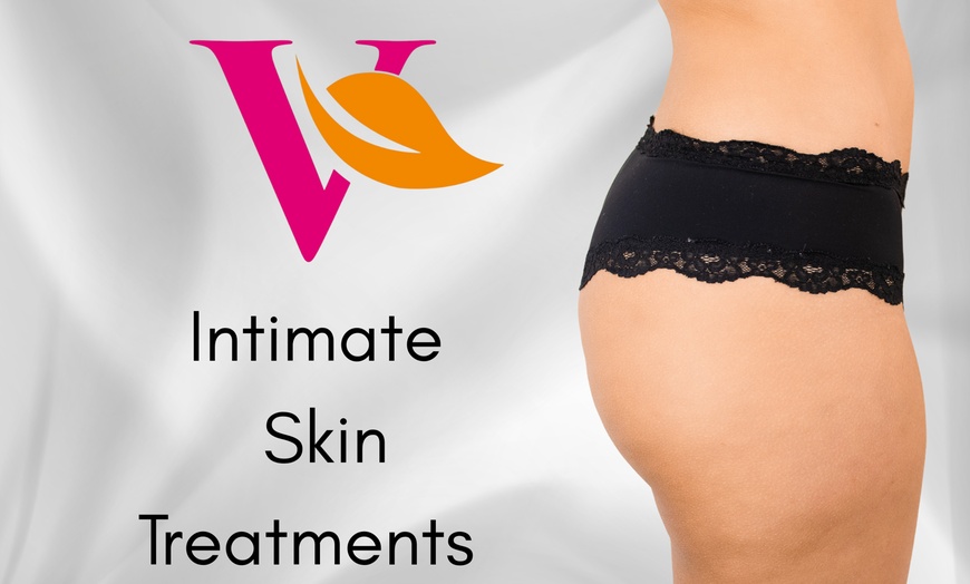 Image 2: Smooth w/ Brazilian Or Hollywood Wax, Underarm Wax, or Intimate Areas