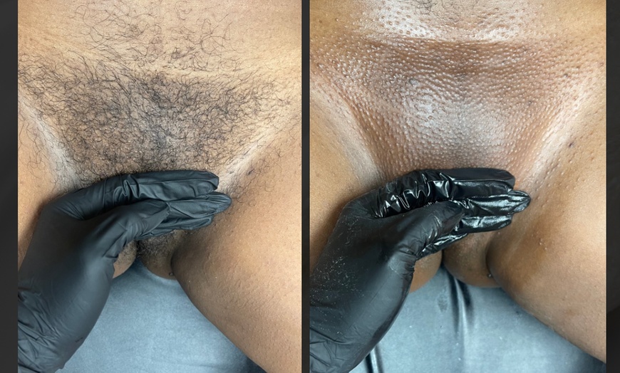 Image 3: Up to 30% Off on Waxing - Brazilian at Madam Wax