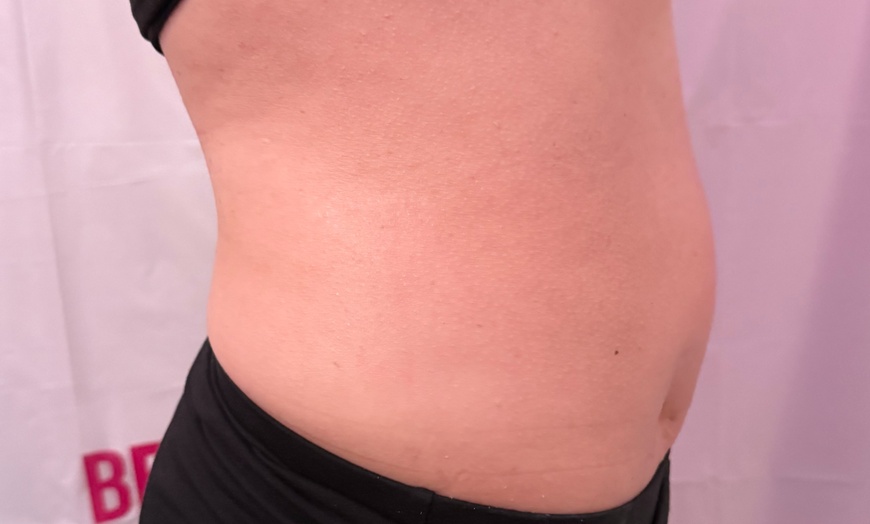 Image 9: Up to 62% Off on Lipo - Non-Invasive Laser-iLipo at Dolly's Beauty Enterprise