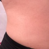 Image 9: Up to 62% Off on Lipo - Non-Invasive Laser-iLipo at Dolly's Beauty Enterprise