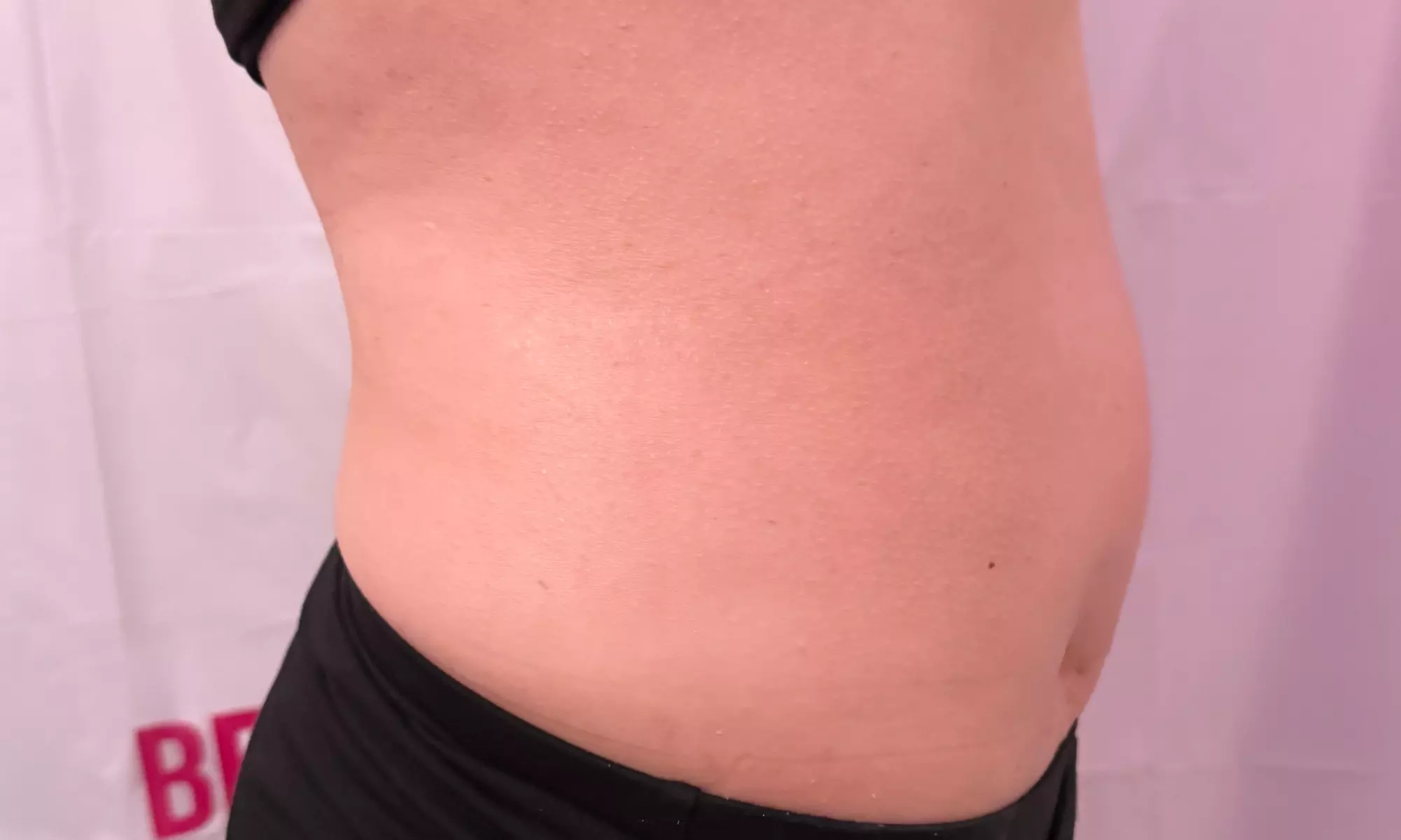 Up to 62% Off on Lipo - Non-Invasive Laser-iLipo at Dolly's Beauty Enterprise