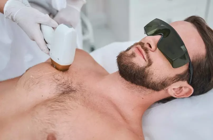Offrez une peau douce et lisse avec l'épilation au laser