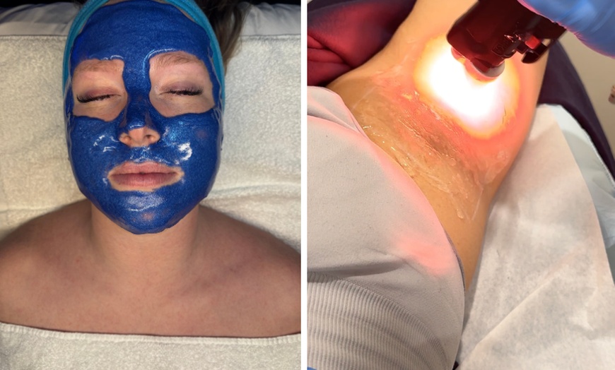 Image 3: Enhance with 20, 40 or 60 Units of Daxxify Plus 1 Syringe RHA (1ml) 