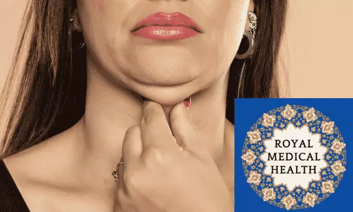 One Kybella Treatment on One Small or Large Area at Royal Medical Health (Up to 60% Off) - Primary Image