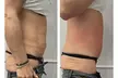 TSHAPE2 Face, Neck, or Stomach Sculpting & Tightening Treatment at MyBliss Wellness Up To  51% Off - Second Medium