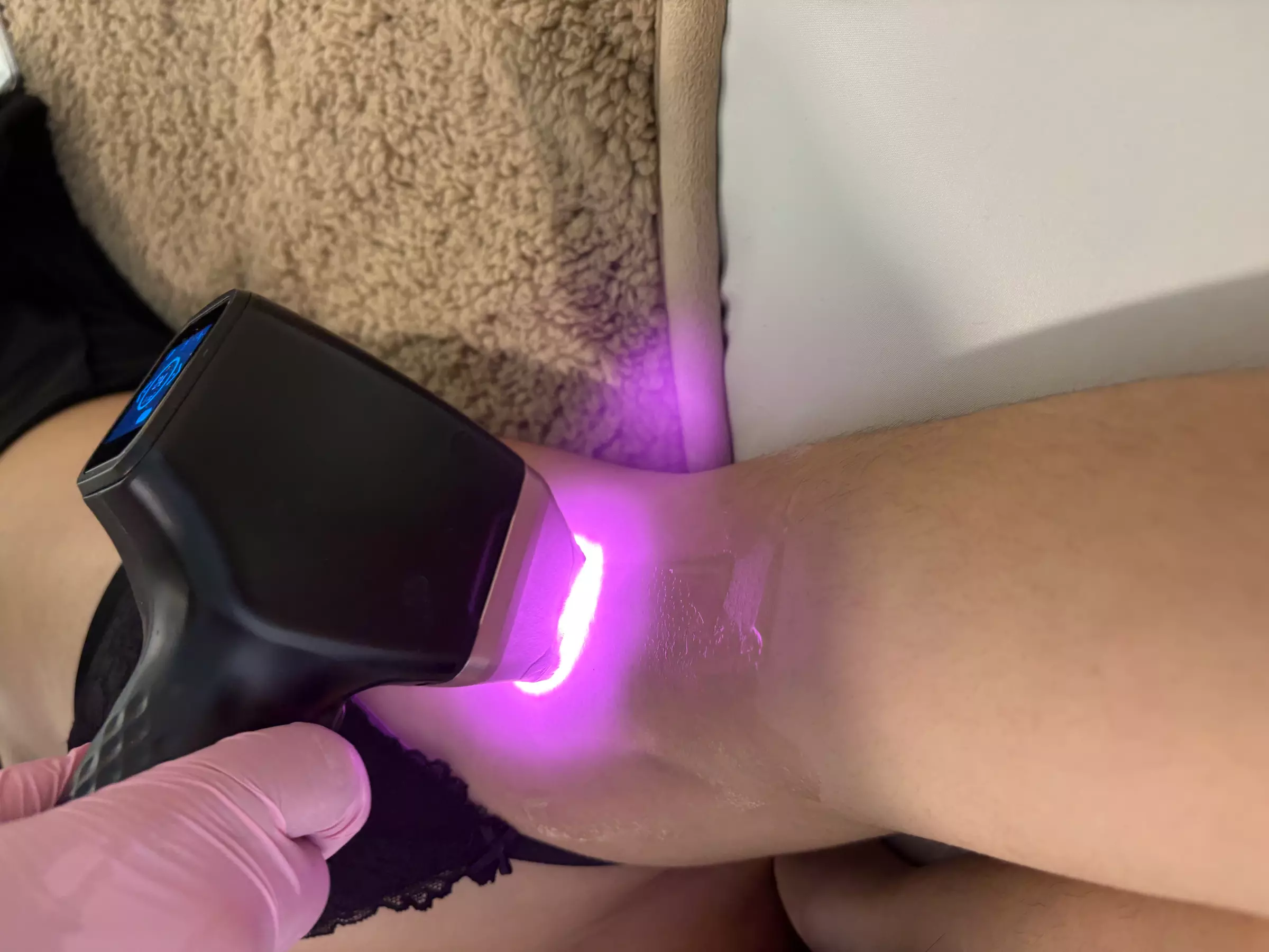 Laser Hair Removal - One Extra Large | Large | Medium | Small Area