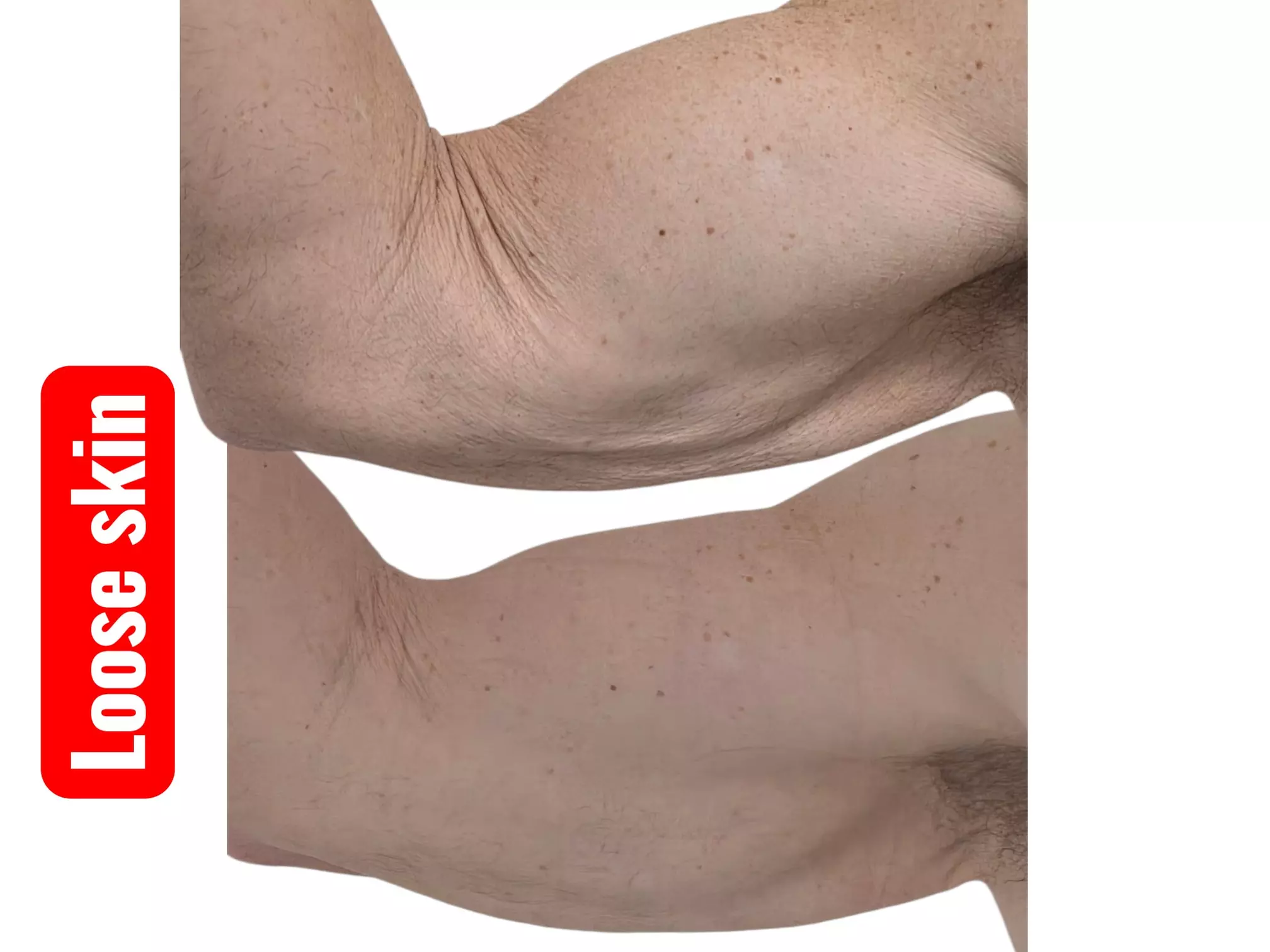 Build Muscle, Tone, and Reduce Fat for a Contoured Look