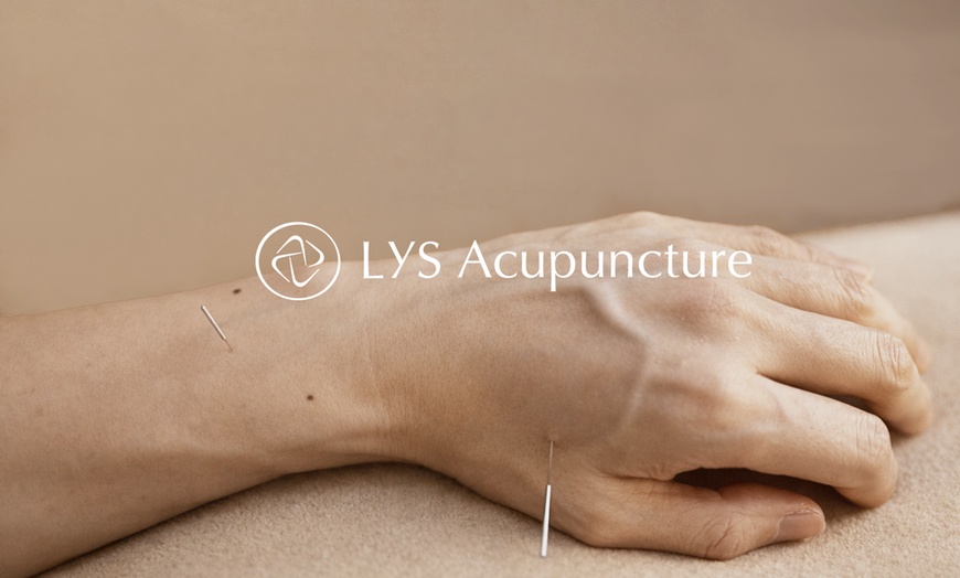 Image 9: 90-Minute Initial Acupuncture or Acupuncture & Cupping Session