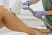 Smooth Skin Awaits: 3 or 6 Laser Hair Removal Sessions on One Small, Medium or Large/XL Area ( Up to 60% Off ) - Second Medium